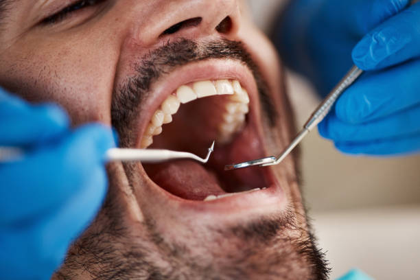 Best Emergency Treatment for Jaw Pain or Injury in Summer Set, MO